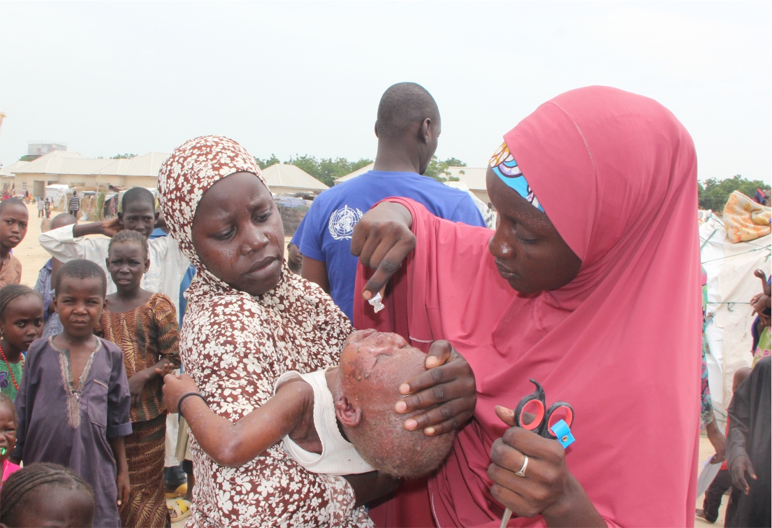 Four Die From Cholera, 36 Others Hospitalised In Adamawa State